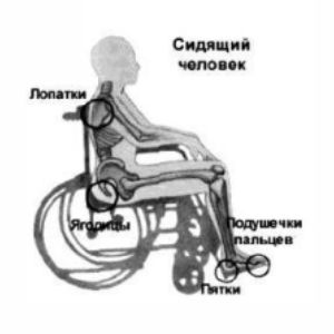риск пролежней у сидячего